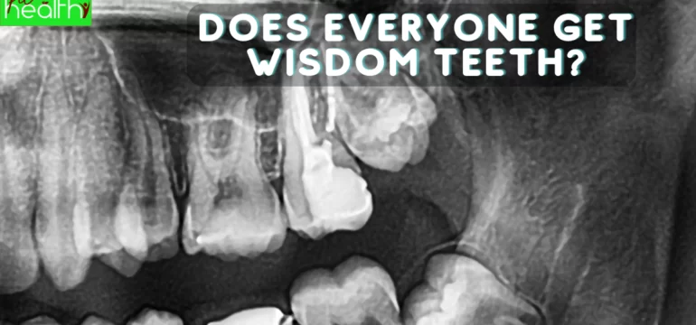 does Everyone Get Wisdom Teeth