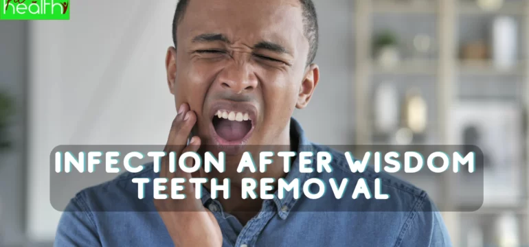 infection After Wisdom Teeth Removal