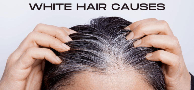 White Hair Causes